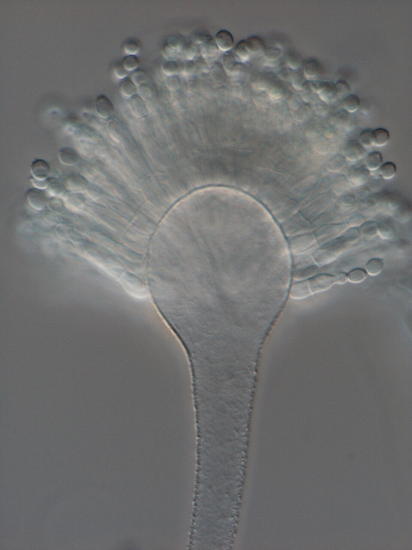 コウジカビの顕微鏡拡大写真　画像：国立科学博物館